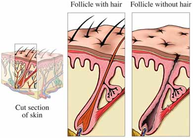 Hair Loss Causes