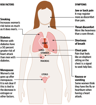 Heart Attack Symtoms in Women