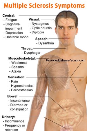 multiple sclerosis symptoms