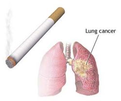 Smoking Causes Lung Cancer